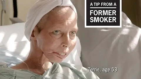 CDC: Tips From Former Smokers - Terrie H.: Surgeon...