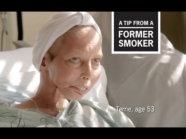 don't smoke cigarettes commercial CDC: Tips From Former Smokers - Terrie H.: Surgeon General Ad