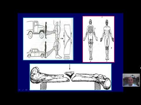 СУДЕБНО МЕДИЦИНСКАЯ ЭКСПЕРТИЗА ПОВРЕЖДЕНИЙ ПРИ ТРАНСПОРТНОМ ТРАВМАТИЗМЕ