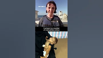UNICEF Gaza Child Hunger At Catastrophic Levels 