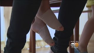 Boy Has Burns On Feet After Trip To Playground