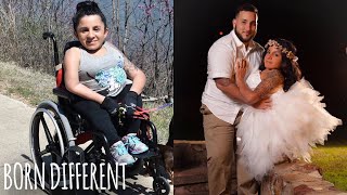 I Have Bones Like Glass, But A Rock Of A Husband | BORN DIFFERENT