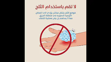 ما الذي يجب تفاديه عند الإصابة بالحرق 