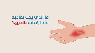 ما الذي يجب تفاديه عند الإصابة بالحرق؟