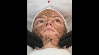 How to Apply ZENA Algae Peeling - Treatment Protocol Resimi