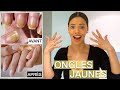 S.O.S Ongles Jaunes: Causes &amp; Comment retrouver des Onlgles Sains ?