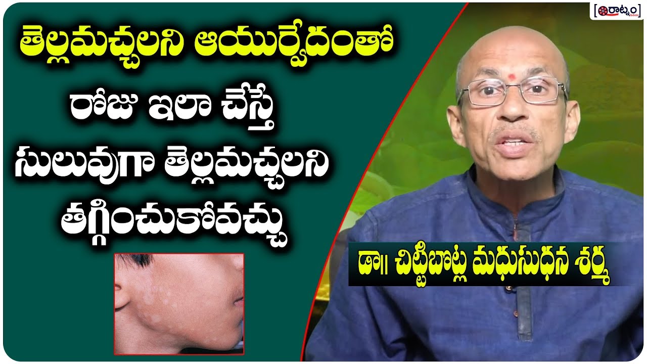 Best Ayurvedic Tips to reduce White Spots on Skin | Chittibotla Madhusudhana Sharma
