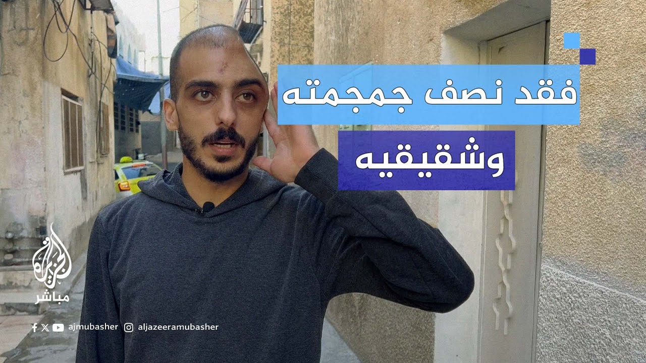فقد نصف جمجمته وشقيقيه.. كيف نجا بشار نعجة من قـصـ.ـف الاحتـلال لمنزلهم في مخيم الفارعة؟