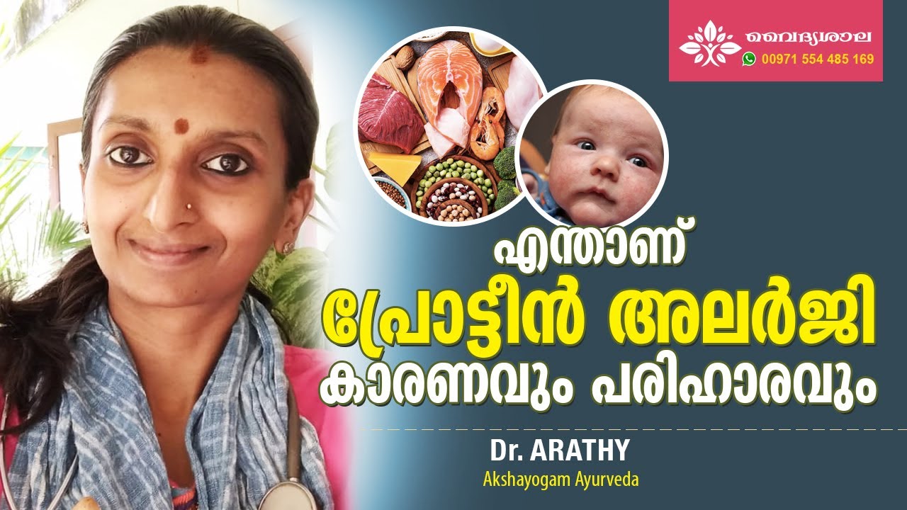 Protein Allergy Malayalam | Protein Allergy Symptoms Malayalam | പ്രോട്ടീൻ അലര്ജി | Dr Arathy