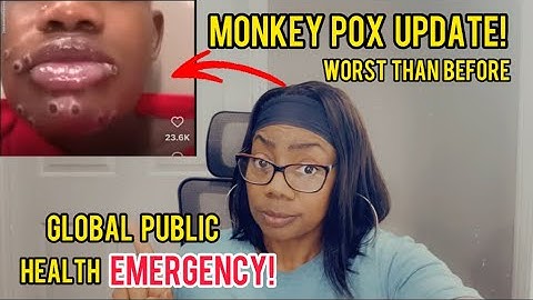 BREAKING! PUBLIC HEALTH EMERGENCY DECLARED...IS THE WORST COMING!