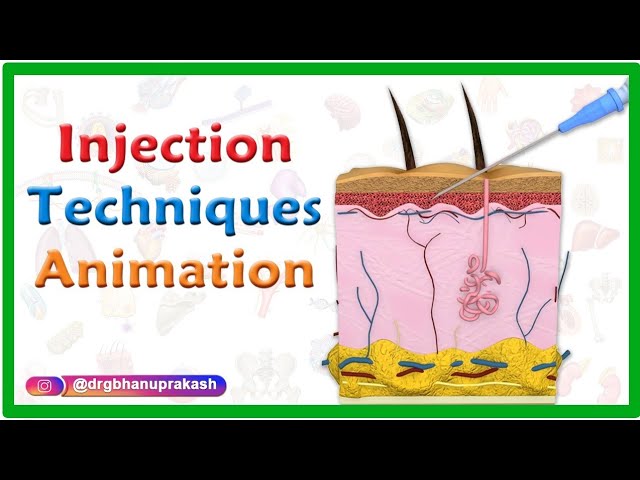 MEDICINE in a Nutshell: IV Cannulae, Syringes & Needles 