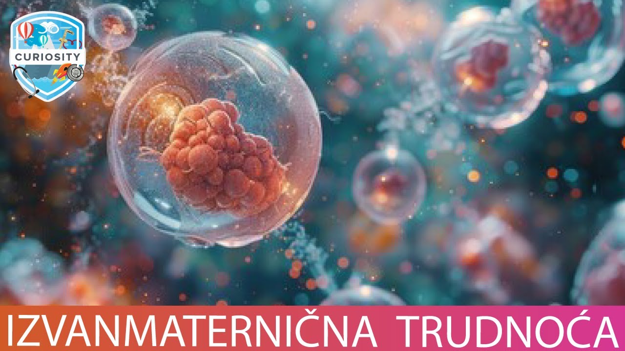 Što je to Izvanmaternična trudnoća  #Dr 112