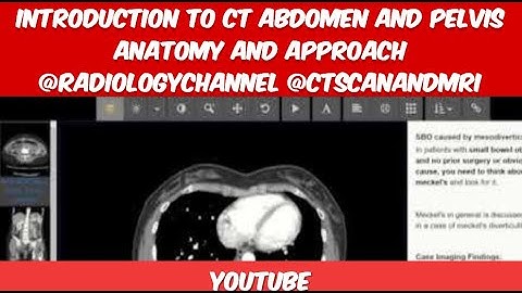 Introduction to CT Abdomen and Pelvis Anatomy and Approach @RadiologyChannel @ctscanandmri