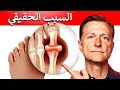 تم كشف اللغز وراء هجمات النقرس ليس فقط حمض اليوريك