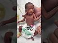 Why Doctors Drop Babies After They Are Born 😳 #shorts