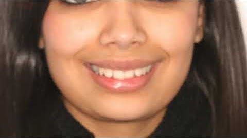 Treatment planning in orthodontics part 1