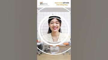 Hành trình LỘT XÁC nhờ niềng răng của khách hàng Hải Ninh