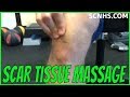 Self Scar Tissue Massage | Post Surgery Treatment