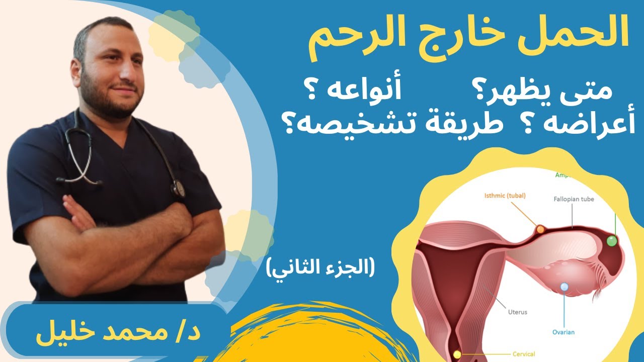 الحمل خارج الرحم الجزء 2 / متى يظهر الحمل خارج الرحم و ما هي اعراضه و انواعه و طريقة تشخيصه
