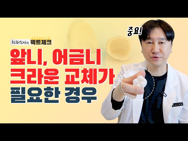 앞니, 어금니 크라운교체 꼭 해야 할까❓ | 크라운 교체 시기, 이유, 수명