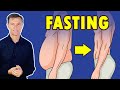 Intermittent Fasting for SERIOUS Weight Loss - Dr. Berg