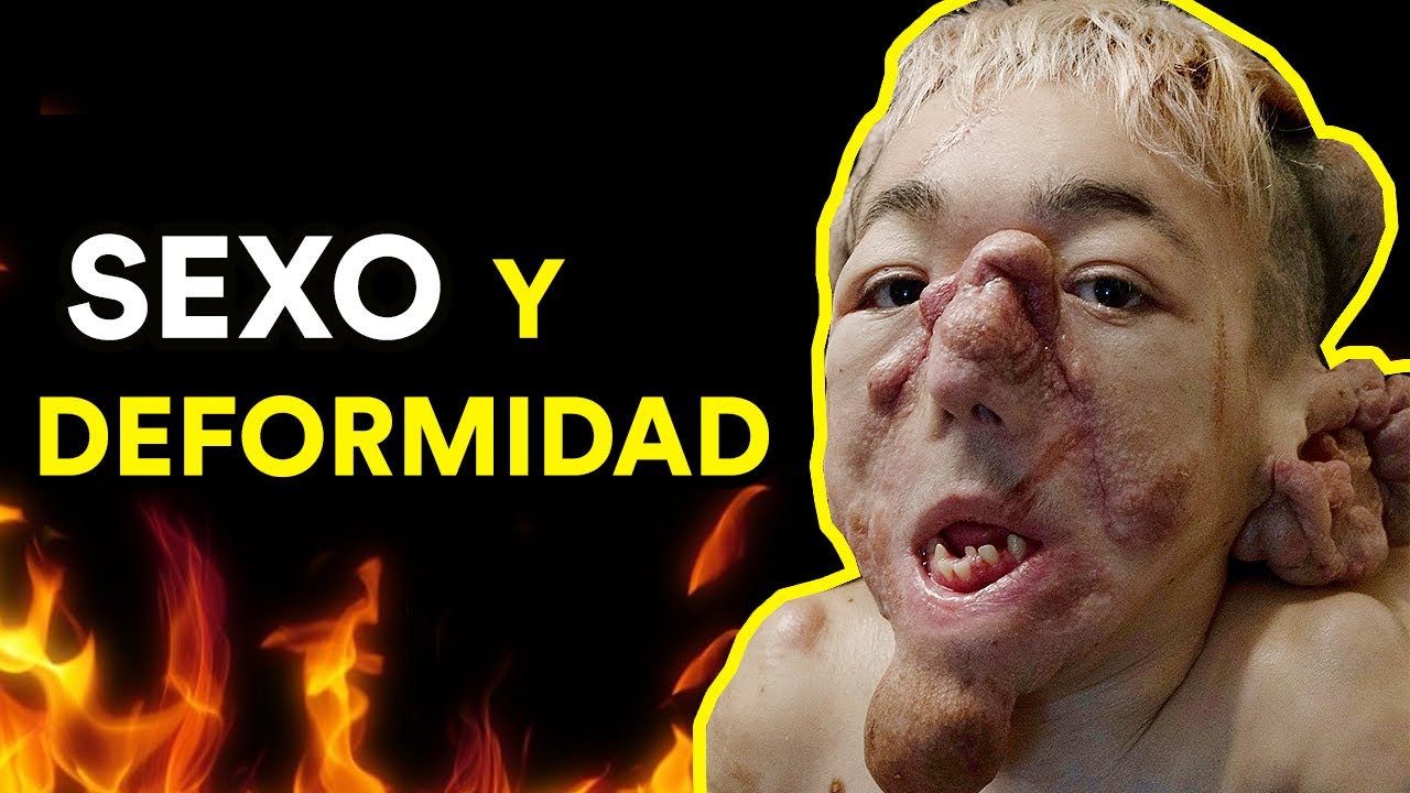 "SOY DEFORME Y QUIERO TENER SEXO" (Entrevista a Mati Fernandez)