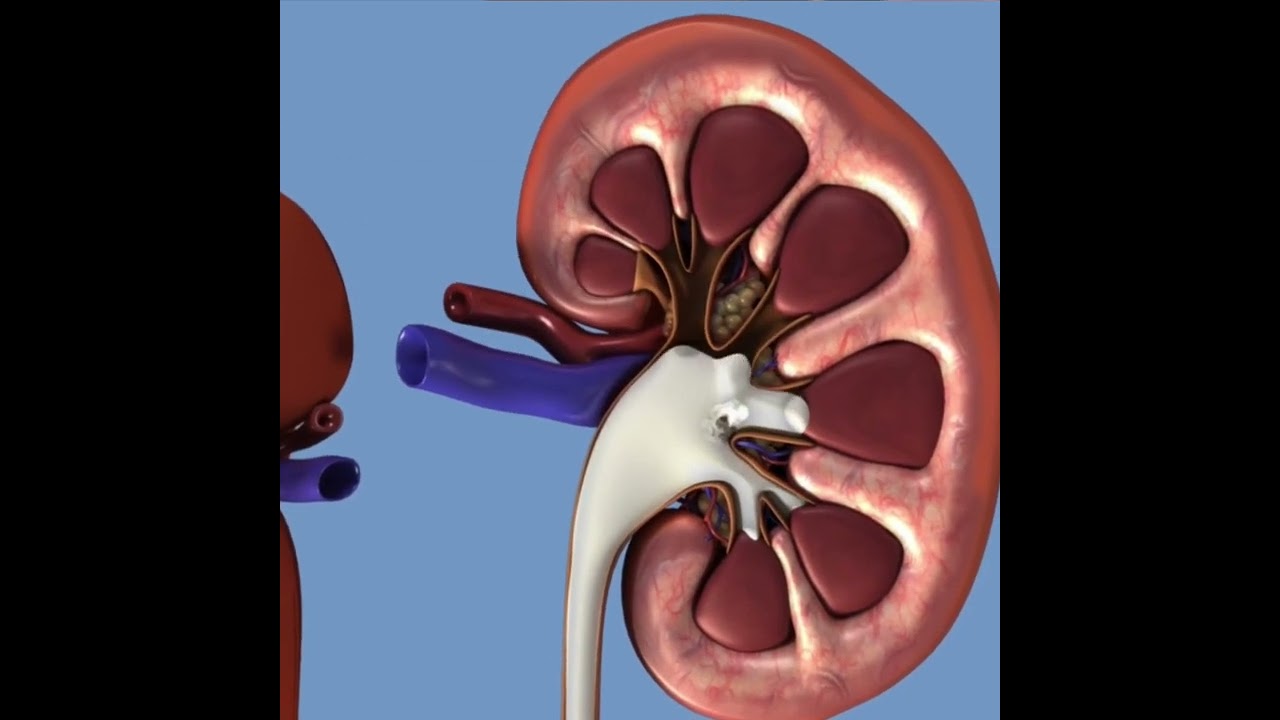 Retrograde Pyelogram