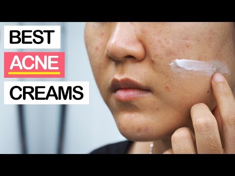  Best Creams for Acne Treatment  | Best Products for Pimples, Zits, Blemishes & Oily Skin
