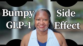 GLP-1 Injection Sites &amp; Lipohypertrophy: Allanda180’s Experience + Common Reactions!