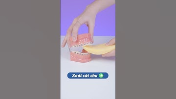 Niềng răng nên ăn loại hoa quả nào? | Lạc Việt Intech Niềng Răng #shorts