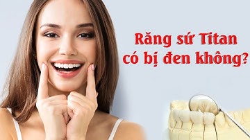 Răng sứ titan có bị đen không? | Răng sứ titan giá bao nhiêu? | Răng sứ titan có bền không?