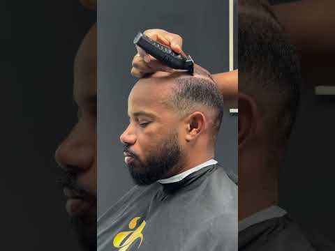 आदमी ने लगाए नकली बाल #shortsfeed