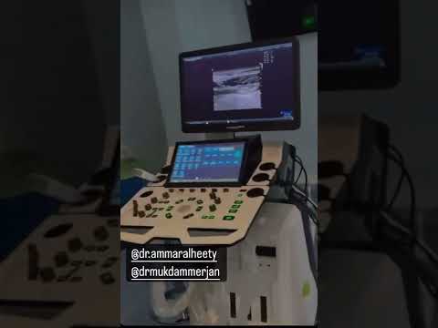 عملية مرتضى اركان يعمل عملية نحت ومعاه شيماء قاسم شاهد قبل الحذف