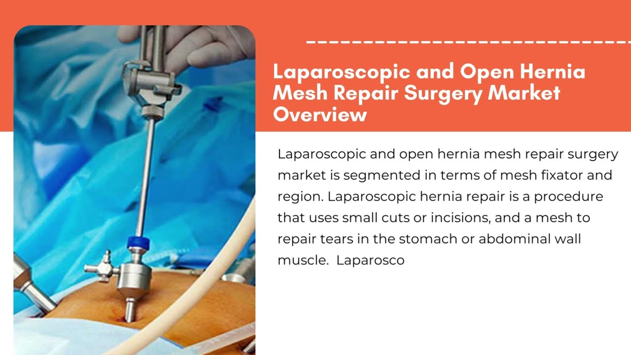 Laparoscopic and Open Hernia Mesh Repair Surgery Market Size, Share | Exactitude Consultancy