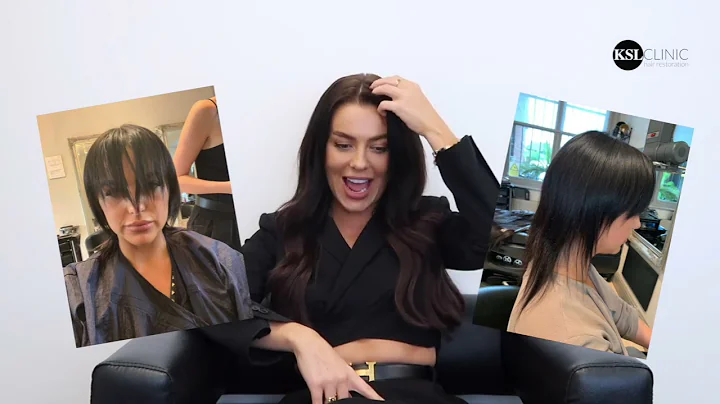 Rosie Williams Hair Transplant Surgery