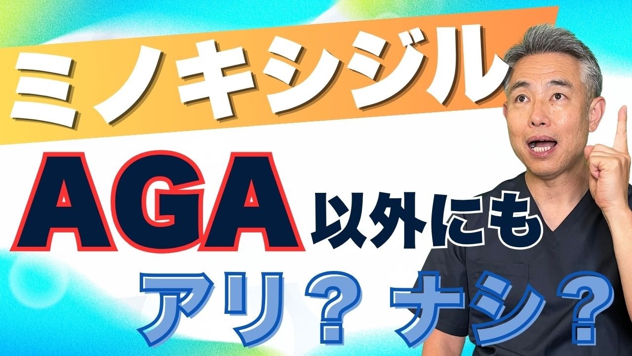 【意外な事実】ミノキシジルをAGA以外で使うのはアリ？ナシ？