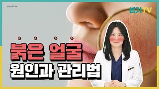 붉은얼굴 원인 알고 이렇게 관리해봐요