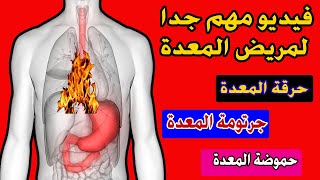 تعرف على طرق التخلص من حرقة المعدة و الحموضة وجرتومة المعدة وأسبابها