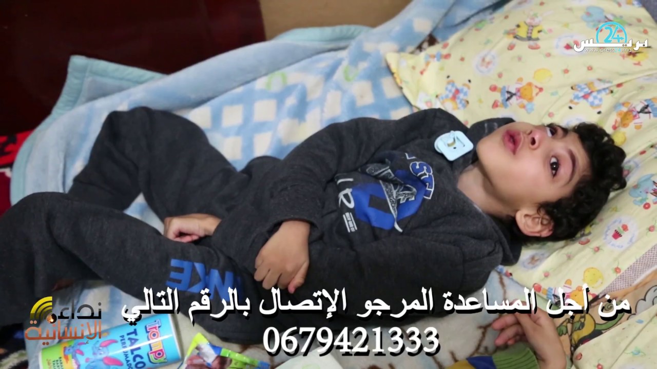 معاناة تدمي القلوب..إعاقة ذهنية وحركية لطفلين والأم تعاني الفقر