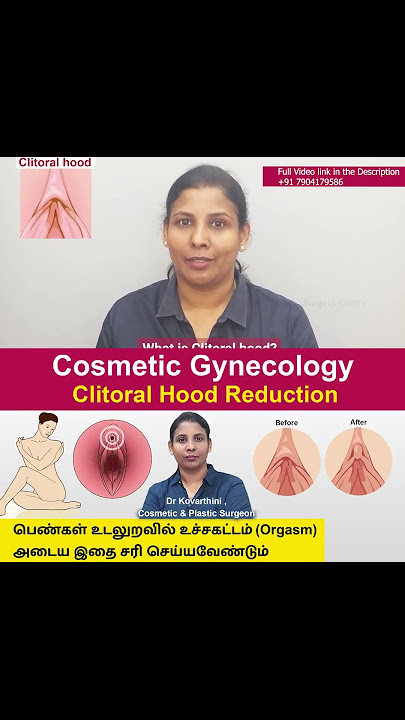Cosmetic Gynecology |Clitoral Hood Reduction | Dr. Kovarthini Cosmetic & Plastic Surgeon