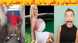 بزرگترین اعضای بدن در جهان! ببین اگر باور نداری، دراخیر ویدیو یک دوتا افغان