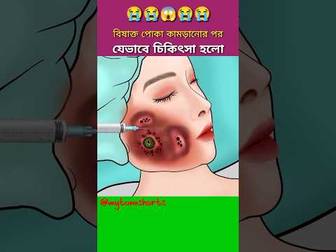 ভিডিও: টিক কামড়ের চিকিৎসা করার টি উপায়