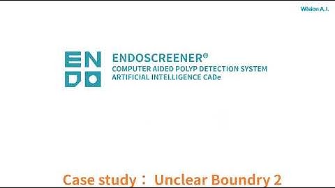 Real-Time Polyp Detection AI For Unclear Boundry Cases