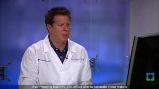 Pathology Insights: Osteoblastic Lesions with Scott Kilpatrick, MD