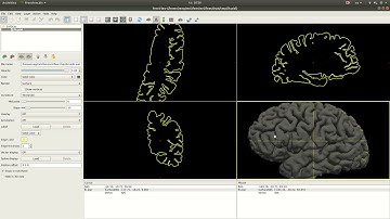 mri2fem: Creating a mesh conforming to gray and white matter using SVM-Tk and FreeSurfer surfaces