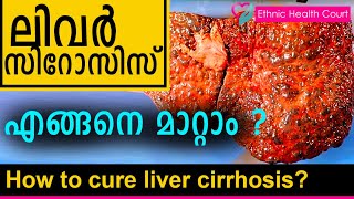 How to cure liver cirrhosis|ലിവർ സിറോസിസ് എങ്ങനെ മാറ്റാമെന്ന് ഡോക്ടർ വിവരിക്കുന്നു|EthnicHealthCourt