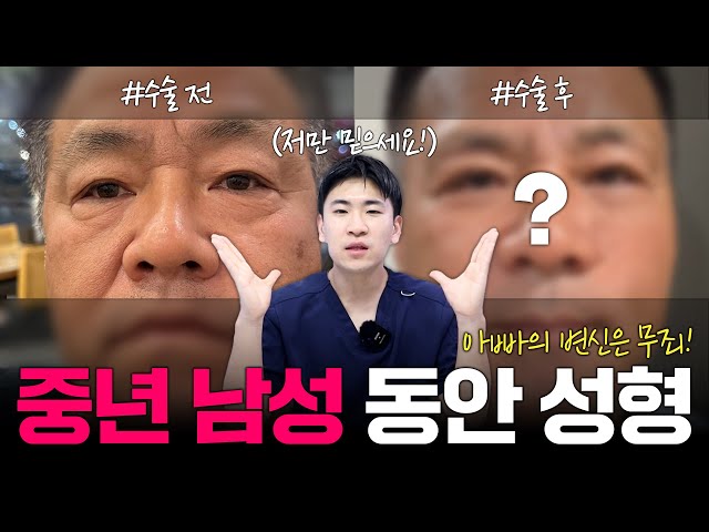 [성형V-log] 돌아온 아빠의 청춘?!🔥 친구들도 부러워하는 60대 중년 남성 성형 VLOG | 저스트성형외과