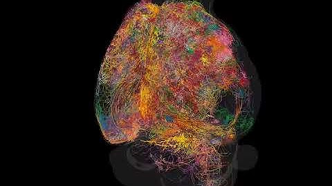 Video of the Day: Brain Map
