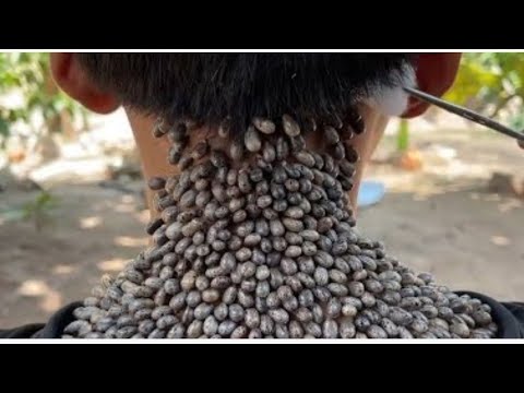 Устранение сотен клещей в человеческом теле