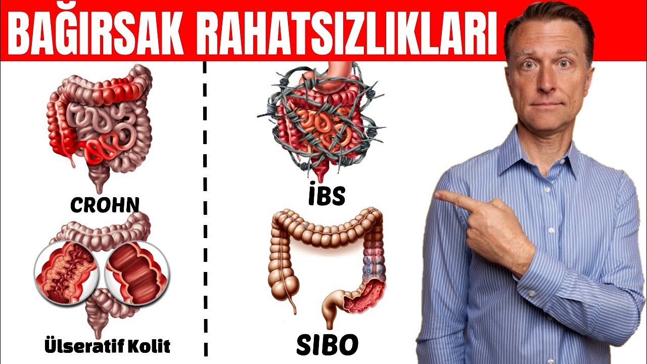 Bağırsak Rahatsızlıkları (Crohn, İBS, Ülseratif Kolit, SIBO) İçin En Kolay Test | Dr.Berg Türkçe